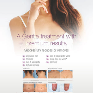 GentleMax Pro Plus Bannerstand - Comprehensive [sf:MCMF55SC3WTNAGLIRWD2ZJTOQK5E]
