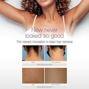 GentleMax Pro Plus Patient Bannerstand - Hair Removal [sf:MCAH7WH2STNVD7PIRPWUNPCC42WQ]