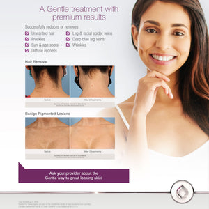 GentleMax Pro Plus Patient Poster - Comprehensive [sf:MCJV266ULZW5GEPHO5SHU24GCNDQ]