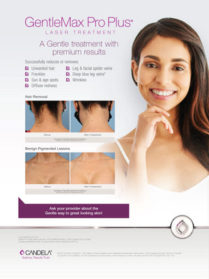 GentleMax Pro Plus Patient Poster - Comprehensive [sf:MCJV266ULZW5GEPHO5SHU24GCNDQ]