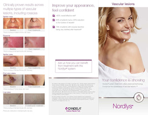 Nordlys Patient Brochure - Vascular Lesions [sf:MCZVG4BQM6MRG2LJXPDEJTIU3LCQ]