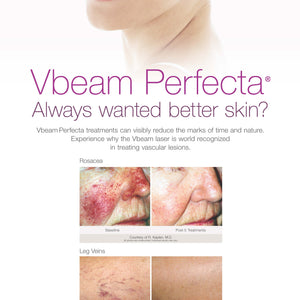 PMK Banner Stand, Vbeam Perfecta [sf:MC7WIZQBNQURFEDF6LNFUQIN5NDY]