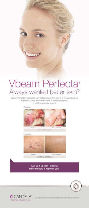 PMK Banner Stand, Vbeam Perfecta [sf:MC7WIZQBNQURFEDF6LNFUQIN5NDY]