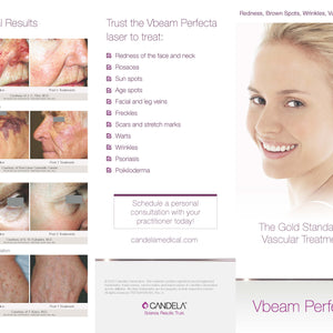 Patient Brochure, Vbeam