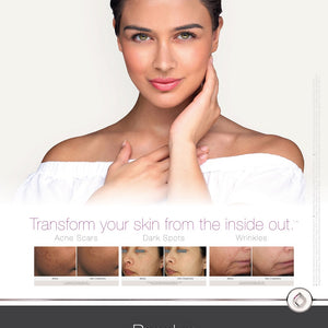 PicoWay Resolve Patient Poster [sf:MCNC7DULWXBJEPXOQCNM2BVPYSGQ]