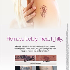PicoWay Tattoo Patient Bannerstand [sf:MCSBPUU57DPNAT3PF6S62AGWCRPI]