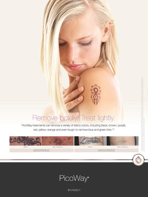 PicoWay Tattoo Patient Poster [sf:MCBZKWGEICIJBPLODKCGEQNMTOVA]