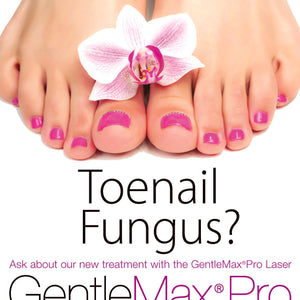 Toe Nail Fungus Counter Card, Gentlemax Pro [sf:MC3NVG3M6MBVAR3LNQMLLBNPIZ2Y]
