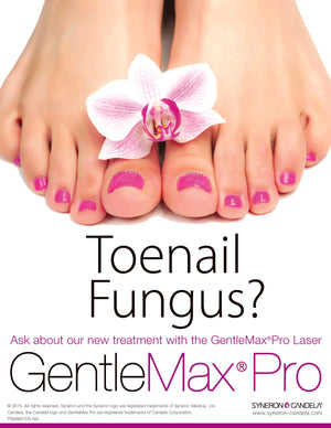 Toe Nail Fungus Counter Card, Gentlemax Pro [sf:MC3NVG3M6MBVAR3LNQMLLBNPIZ2Y]