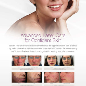 Vbeam Pro Patient Bannerstand [sf:MC5CFVIVPDPZDANEFQNLLR5RWT7U]