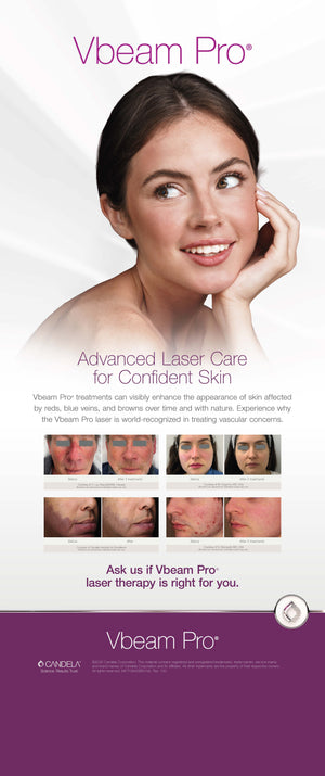 Vbeam Pro Patient Bannerstand [sf:MC5CFVIVPDPZDANEFQNLLR5RWT7U]